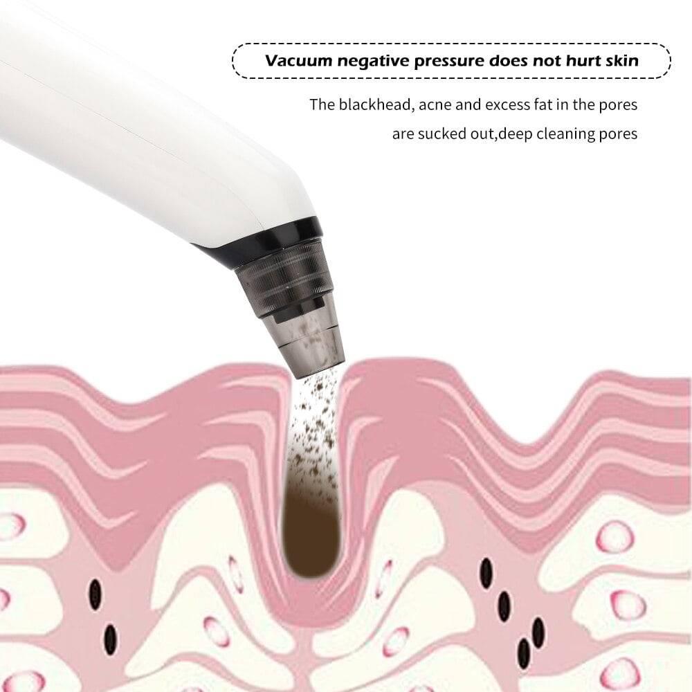 Blackhead Remover Vacuum Pore Cleaner + Mini Nano Facial Steamer Kit